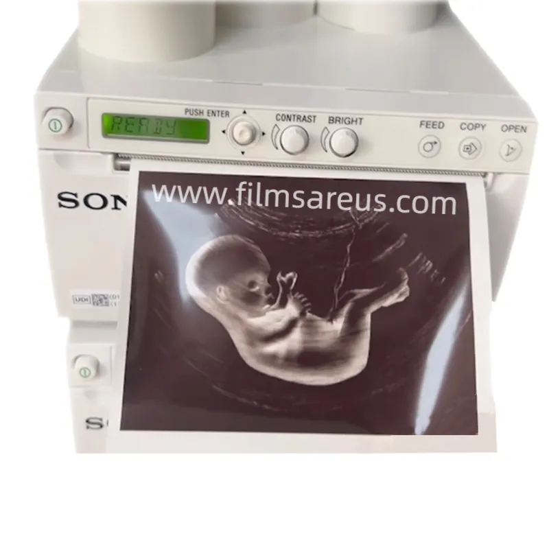 sony ultrasound printing paper alternative