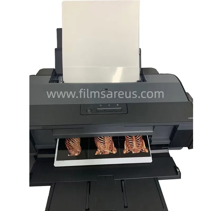 filmsareus white laser medical imaging film